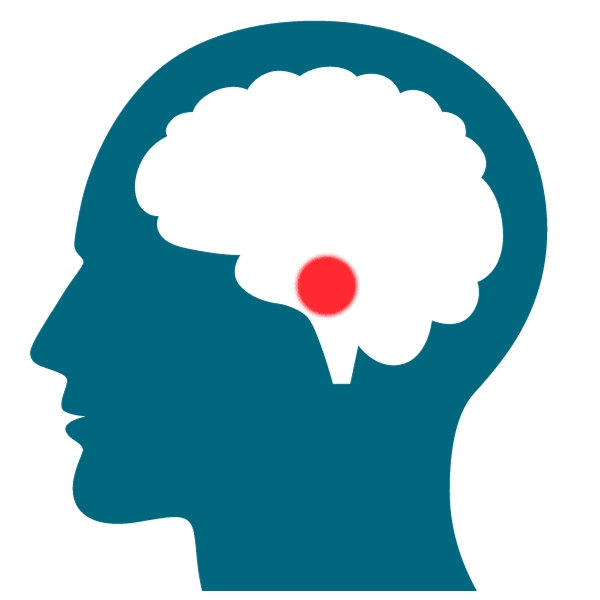 Acoustic neuroma treatment