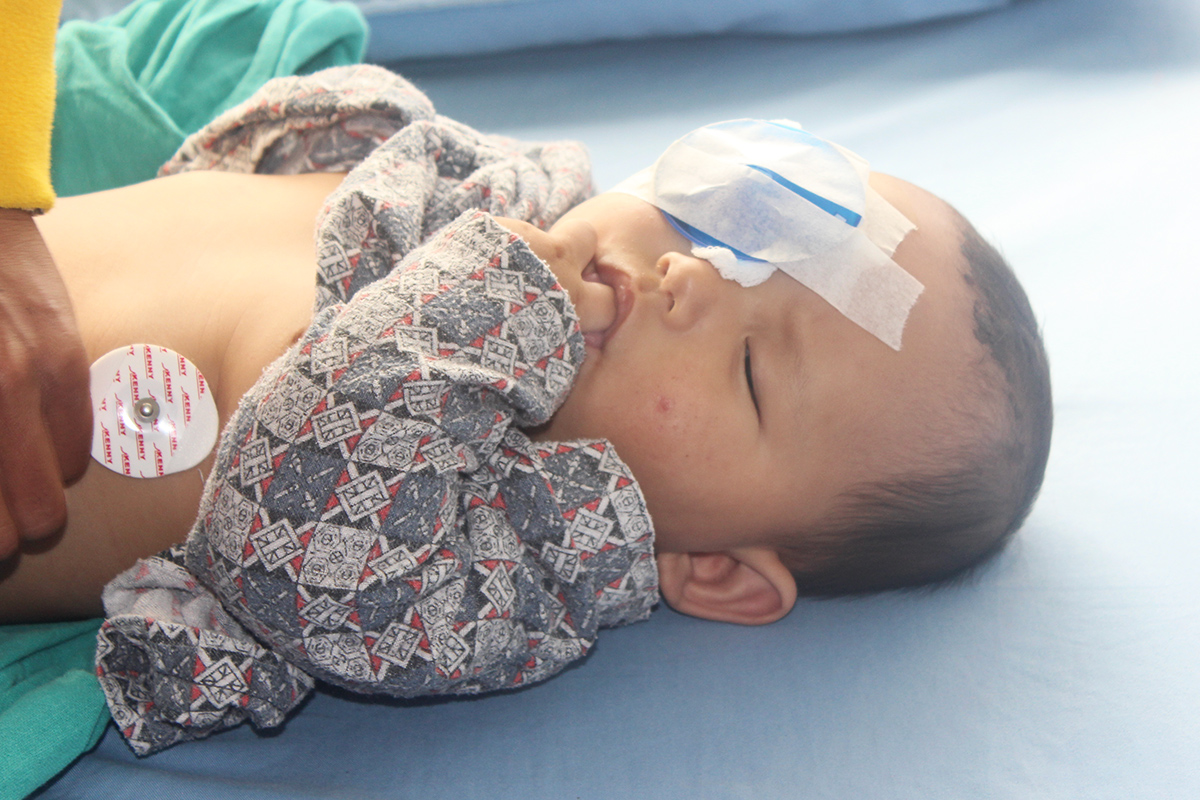 Pediatric Eye Surgery