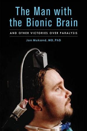 The Man With the Bionic Brain