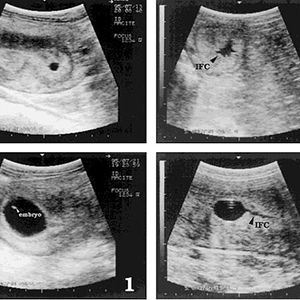 Ultrasound Equipment