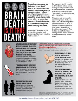 Brain Death Fact Sheet