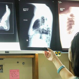 X-Ray