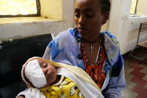 Sponsor Eye Surgery for a Child